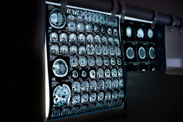 SIMPLIRAD ,cloud based radiology software
