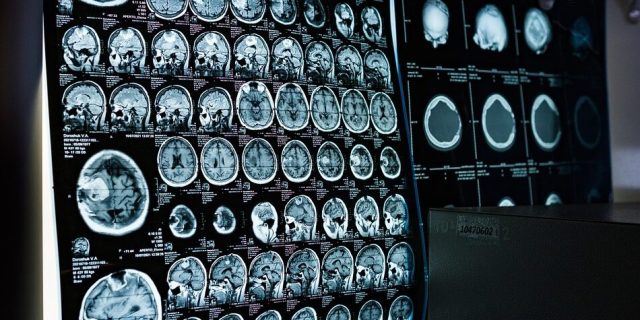 x-ray-6841384_1280 x-ray-6841384_1280