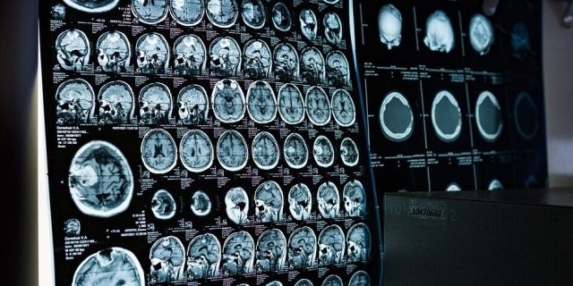 x-ray-6841384_1280